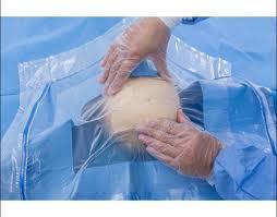 Laminated Sms Fixable Drapes Cranial Drape Model Name/number: St245 - Application: At The Time Of Normal Delivery