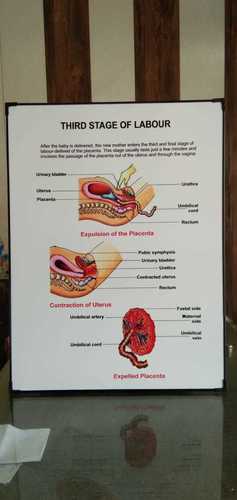 Chart Of Third Stage Of Labour