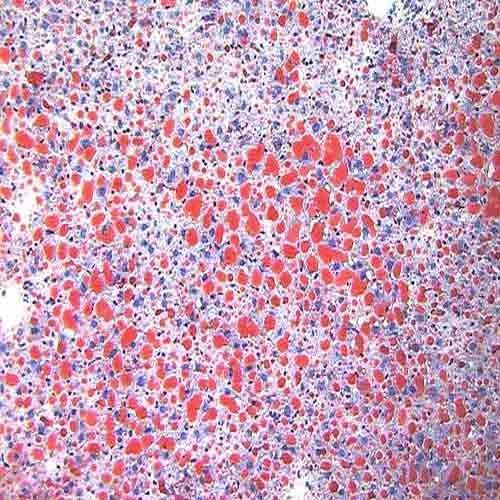 ऑयल रेड डाईज