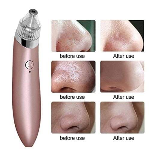 4 In 1 Usb Rechargeable Blackhead Extractor Derma Suction