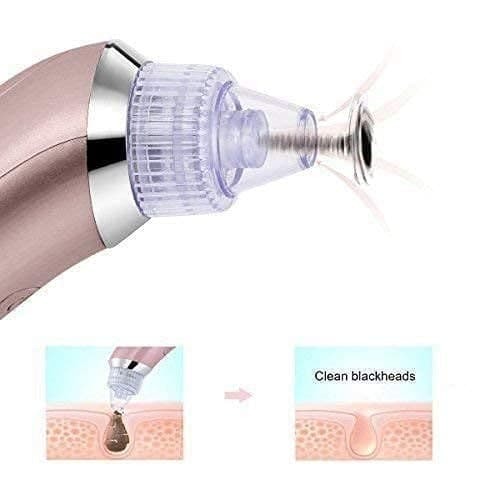 4 In 1 Usb Rechargeable Blackhead Extractor Derma Suction