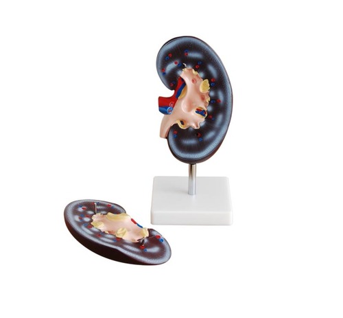 कॉनएक्सपोर्ट किडनी मॉडल (2 भाग)