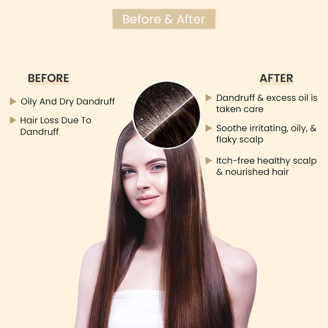 White Soothing Scalp Therapy Shampoo With Tea Tree Oil & Salicylic Acid - 200ml