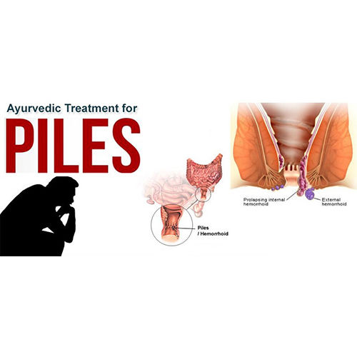 पाइल्स के लिए आयुष क्योर