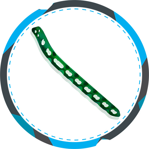 2.7/3.5 मिमी लॉकिंग डिस्टल मेडियल ह्यूमरस प्लेट