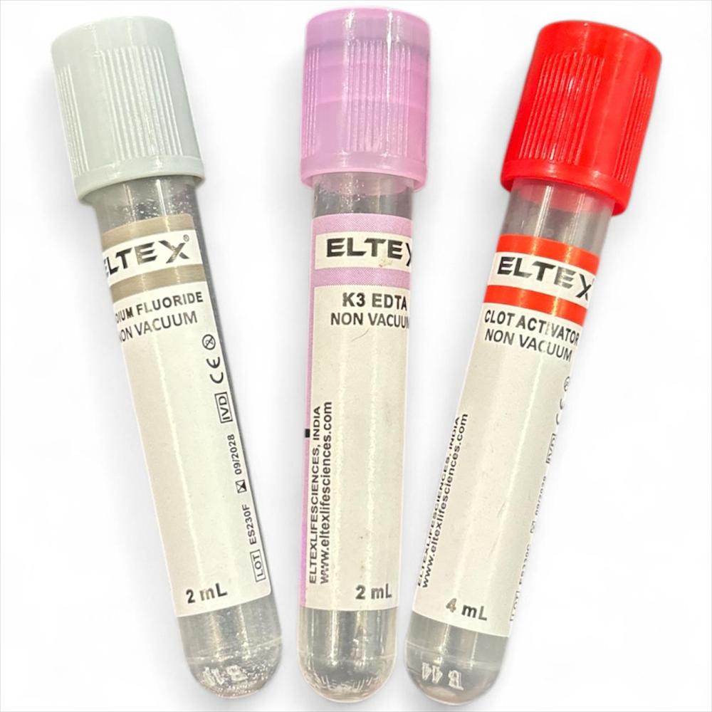 Non Vacuum Blood Collection Tube - Polypropylene, 13x75 mm, Purple & Red Color, 4ml Capacity | Laboratory Use, Disposable Design