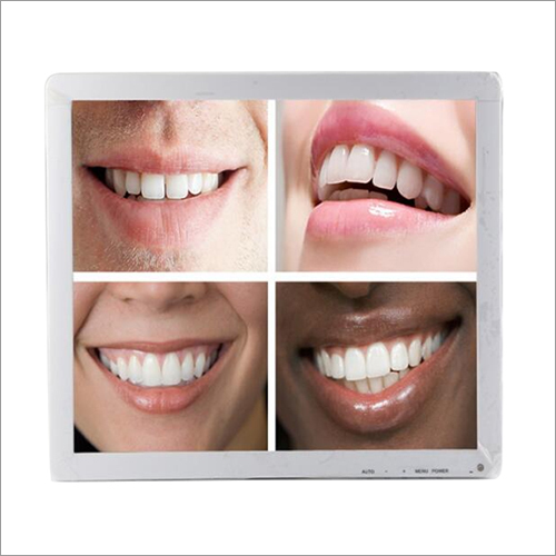 Dental Intoral Camera - Material: Plastic