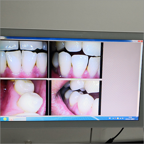 Plastic 19 Inch Intraoral Camera With Touch Screen Monitor