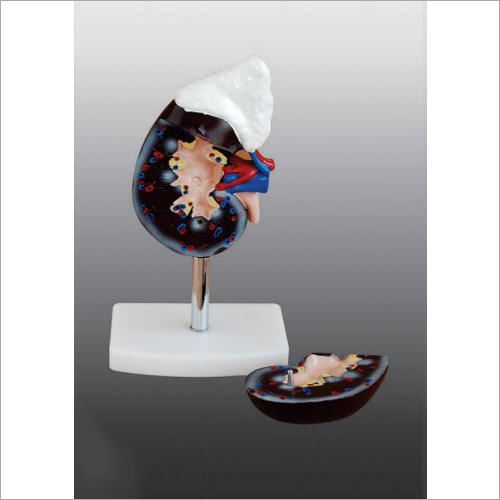 एड्रेनल ग्लैंड मॉडल के साथ प्राकृतिक मानव गुर्दा