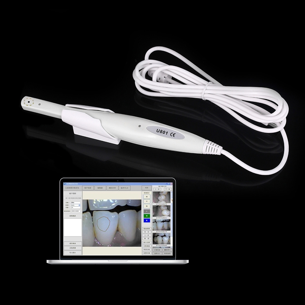 Usb Dental Intraoral Camera - Material: Plastic