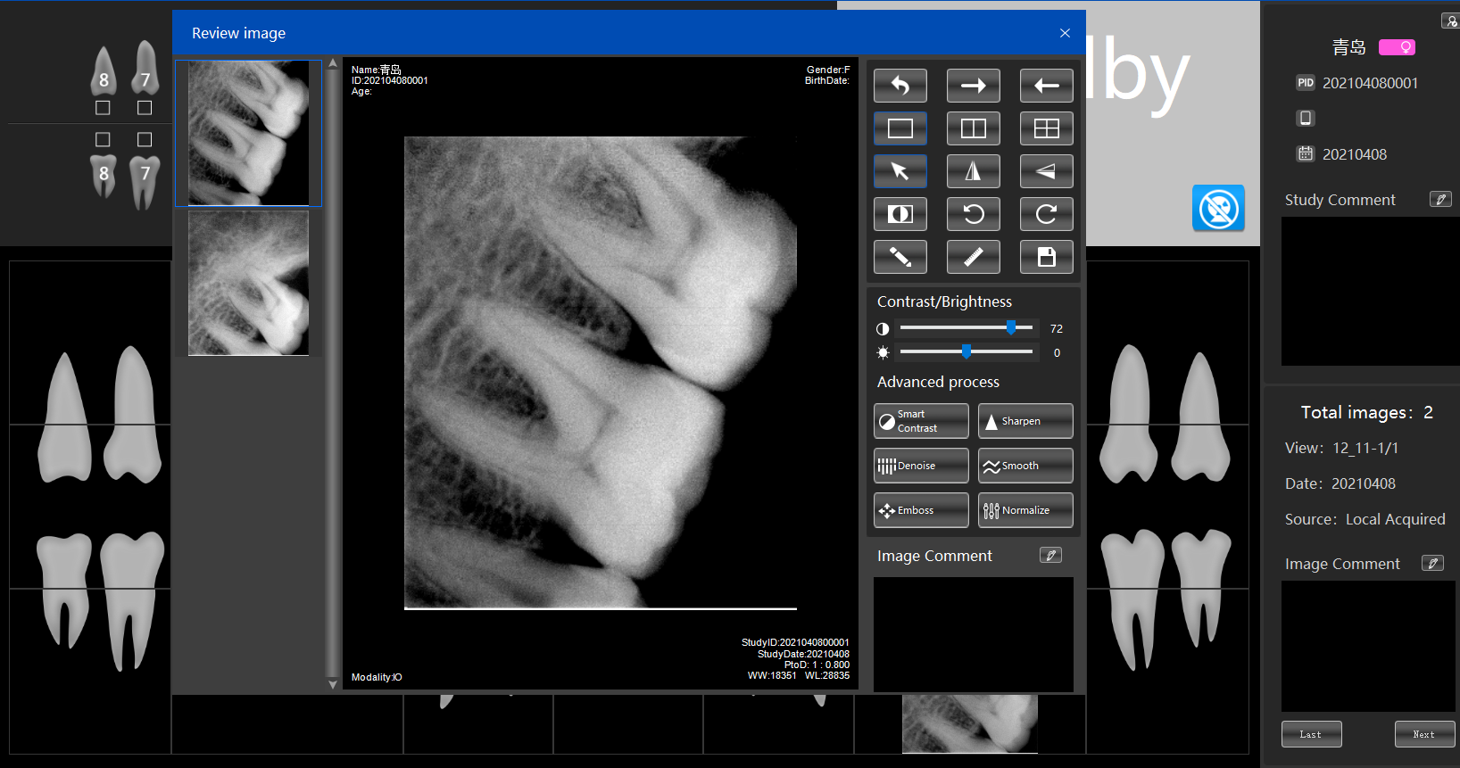 Dental X-ray Sensor - Material: Plastic