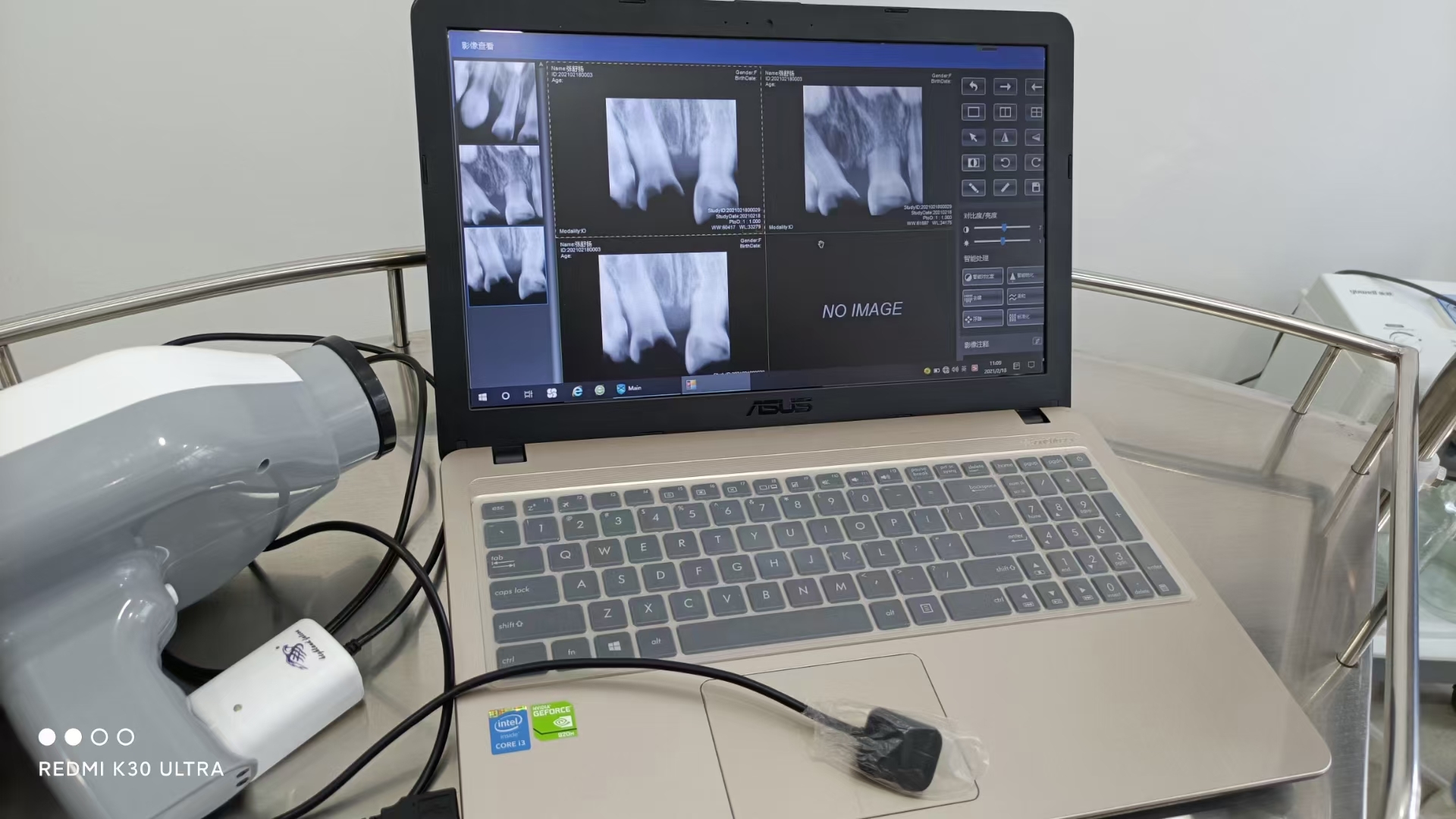 Dental X-ray Sensor - Material: Plastic
