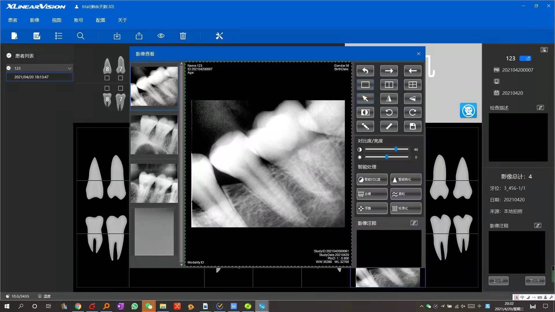 Dental X-ray Sensor - Material: Plastic