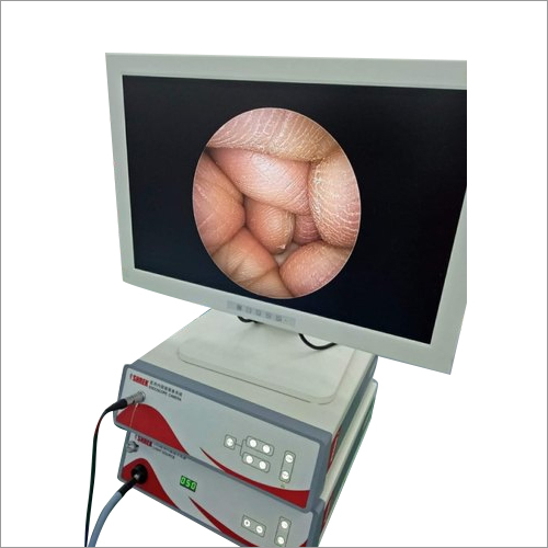 Surgical Endoscopy Camera Monitor Color Code: White