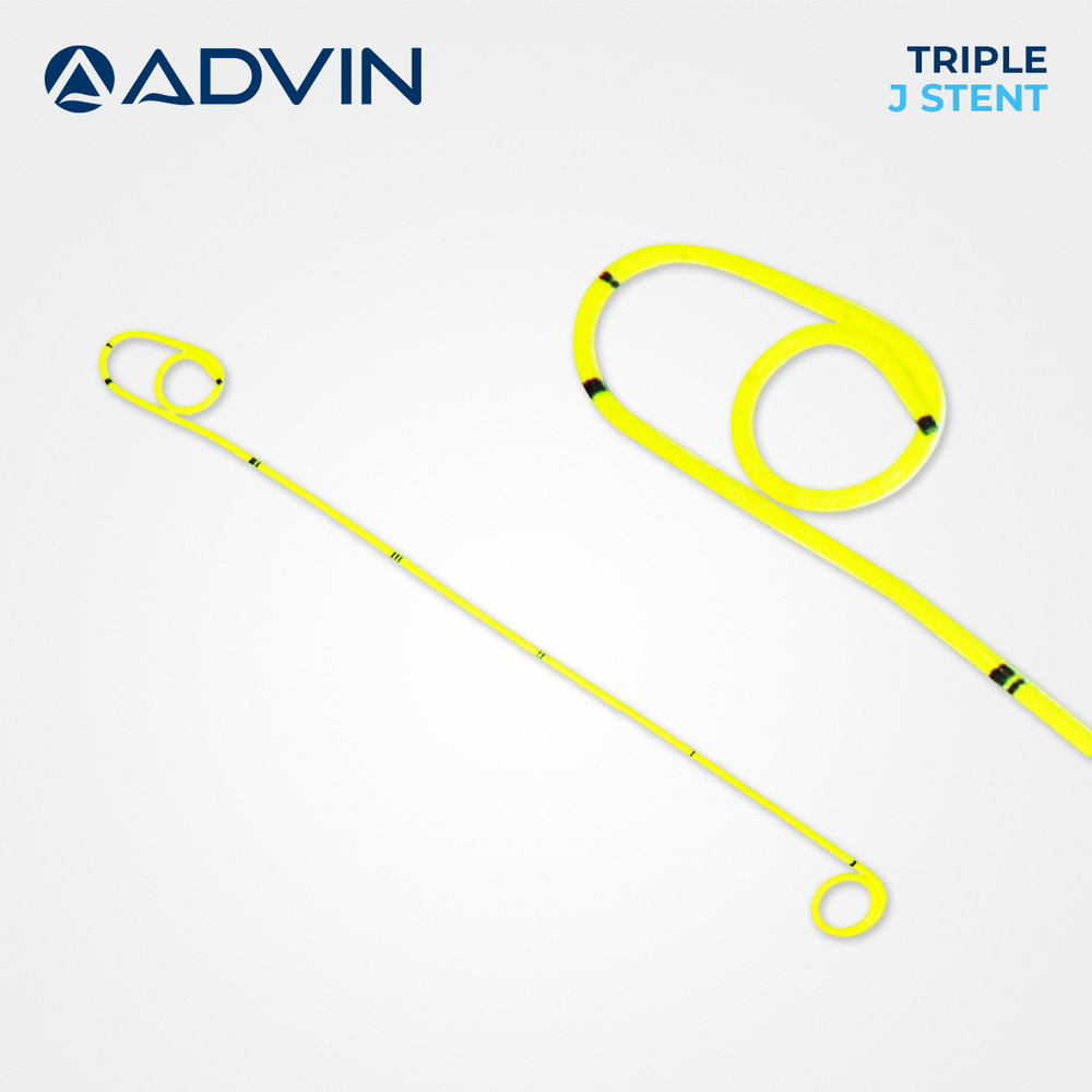 मैनुअल ट्रिपल जे स्टेंट