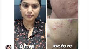 Khushi Skin Whitening Cream Color Code: Whitish