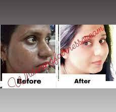 Khushi Skin Whitening Cream Color Code: Whitish