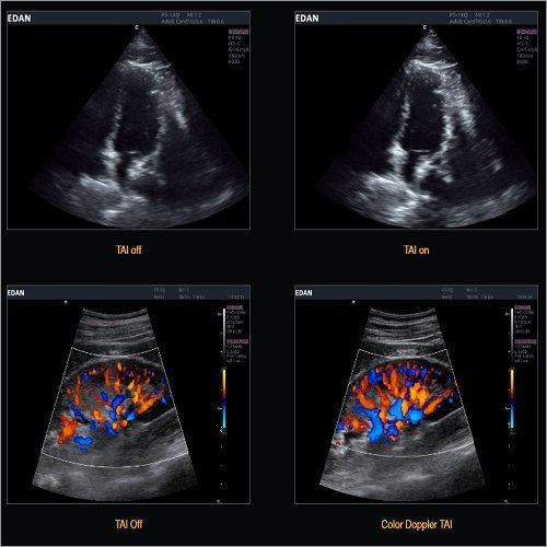 U2 Prime Edition Color Doppler Dimension(l*w*h): 359x320x270 Millimeter (Mm)