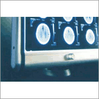 HIgh End X-Ray Film Viewer