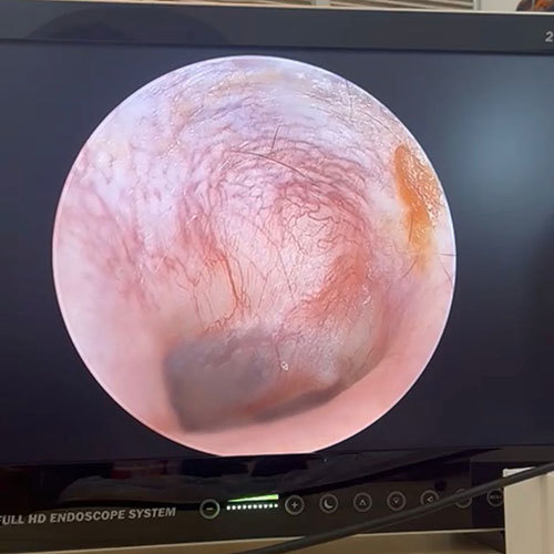 Laparoscopic Camera Color Code: White