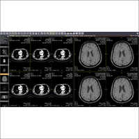 iWeb ट्रू वेब आधारित समाधान