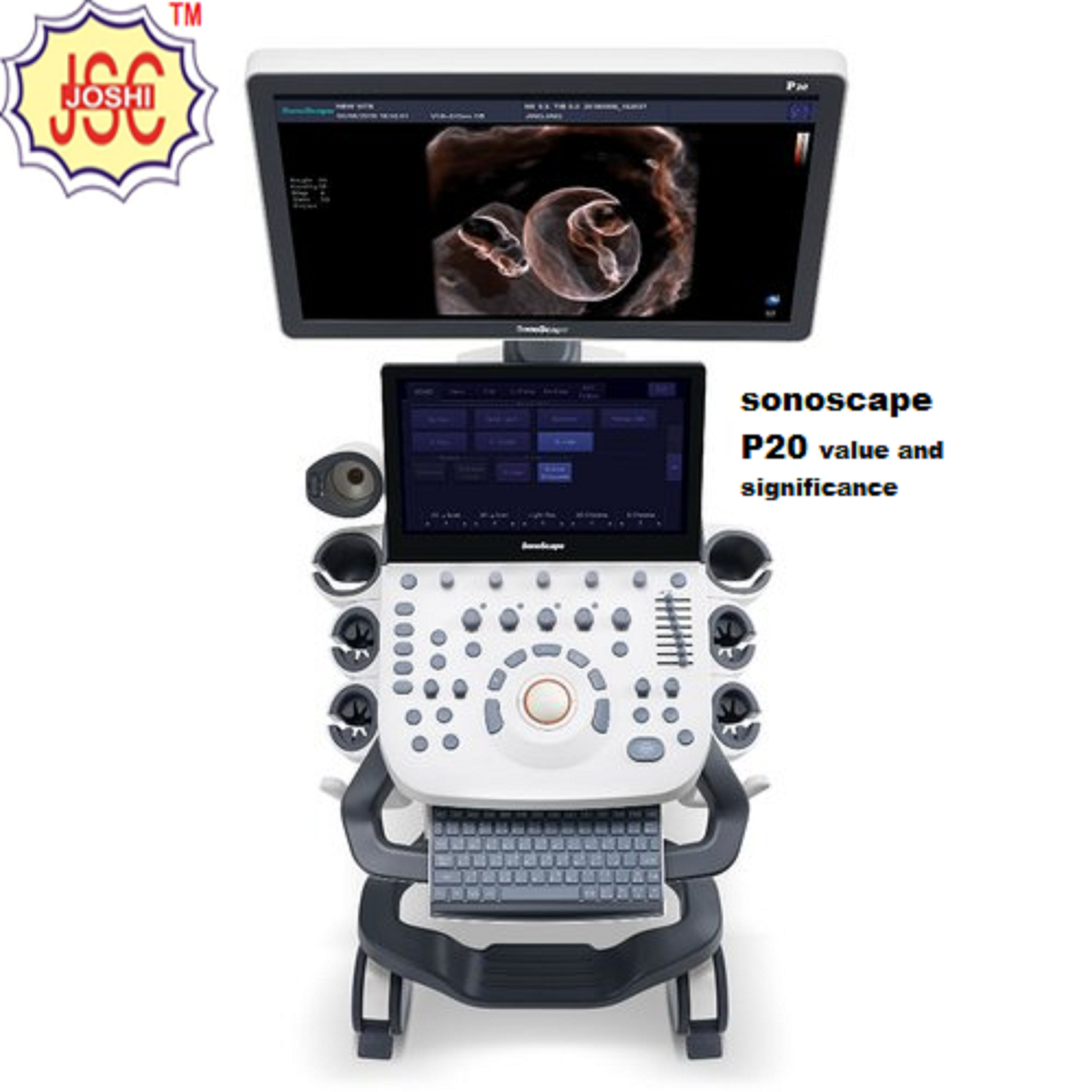 Sonography Machine - Advanced Ultrasound Imaging System | S50, S22, P20, S12 Variants, High Resolution, Compact Design, User-friendly Interface