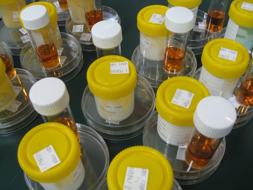 एंटीमाइक्रोबियल प्रभावकारिता परीक्षण