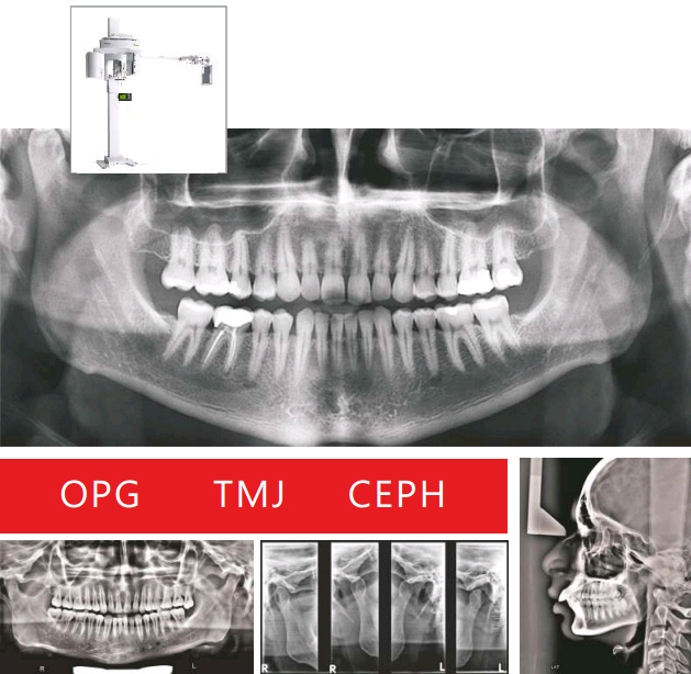 Apex Opg Machine Color Code: White