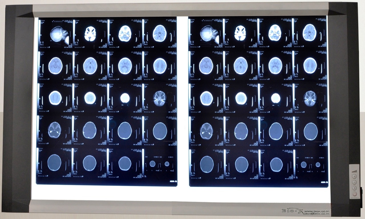 X-ray View Box - Application: Hospital