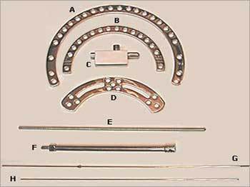 बाहरी फिक्सेटर इलिज़्रोव