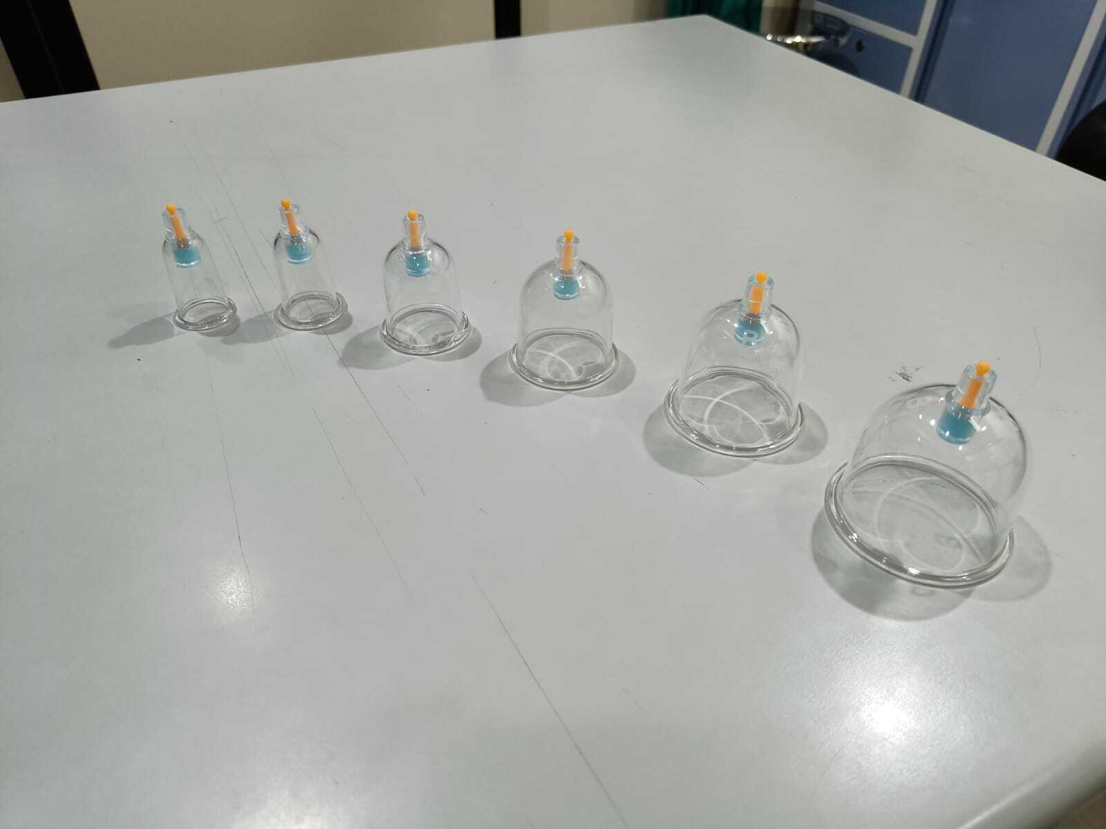 Hijama Cup Imported Dimension(l*w*h): 10x10x10 Centimeter (Cm)