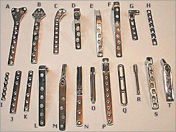 बोन प्लेट्स