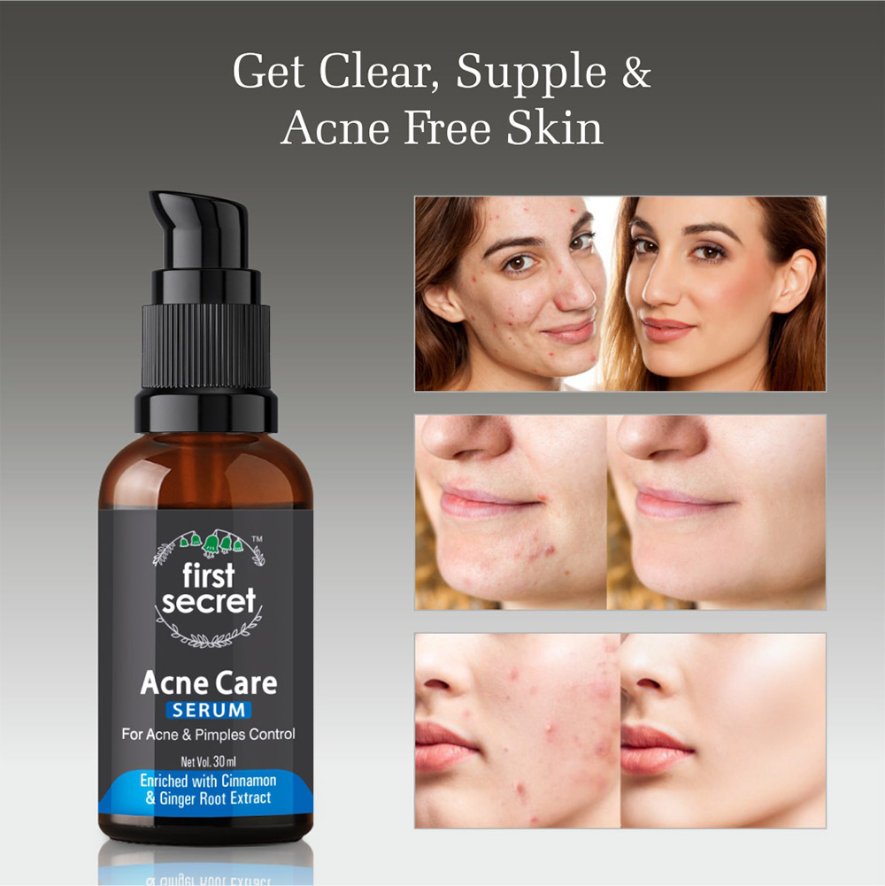First Secret First Secret Acne Care Serum 100% Safe at Best Price in Delhi | First ...