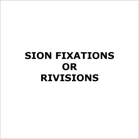 SION फिक्सेशन सेवाएं