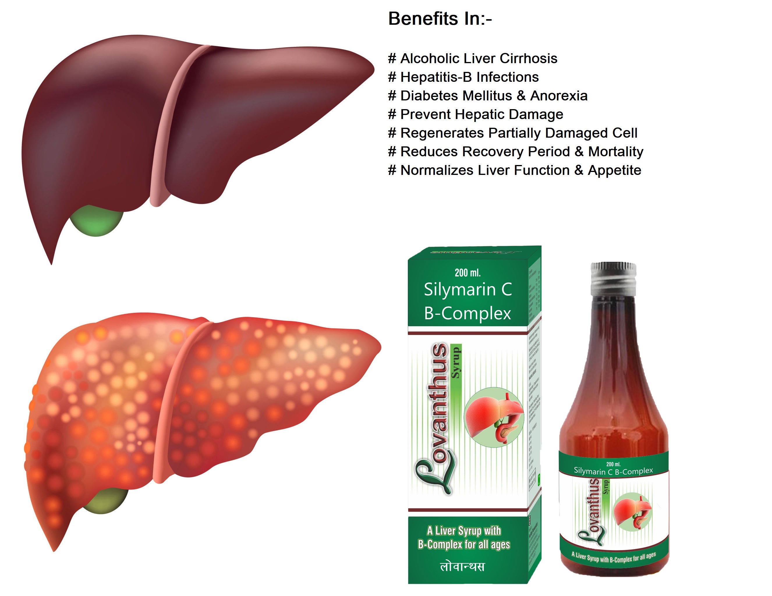 200ml Silymarin C Amd B Complex Lovanthus Syrup - Drug Type: General Medicines
