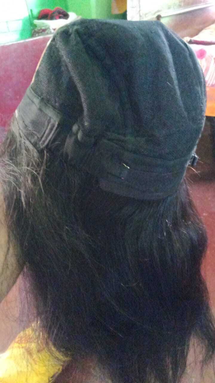Human Hair Patching Services