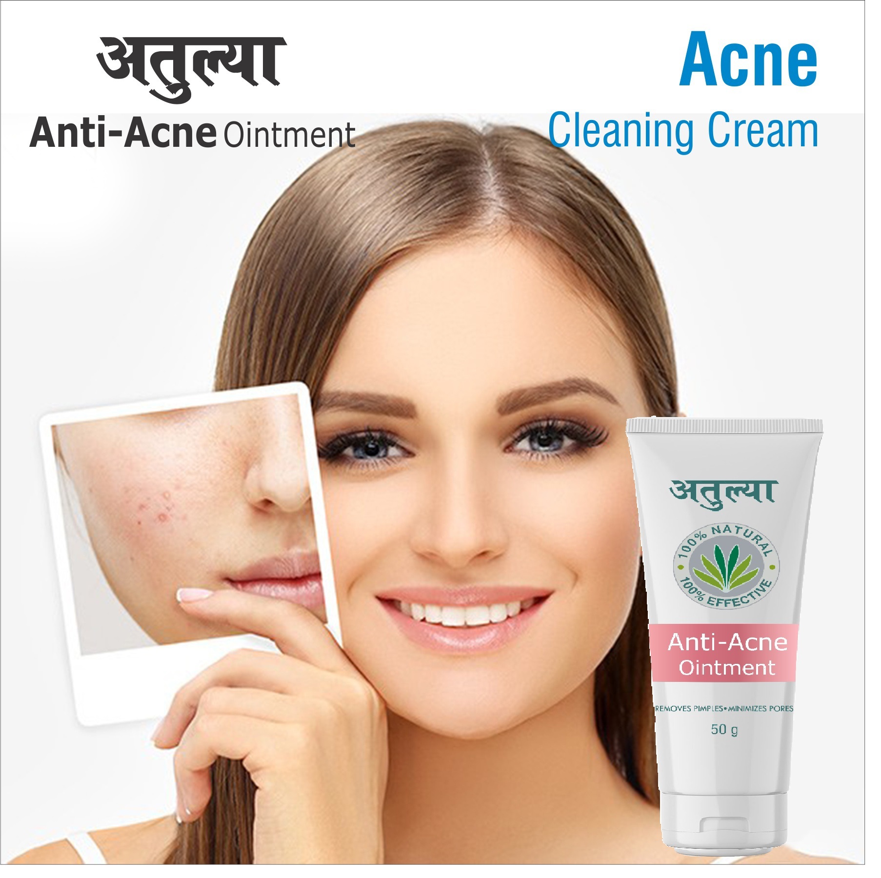 50gm Remove Pimple Minimizes Pores Ointment