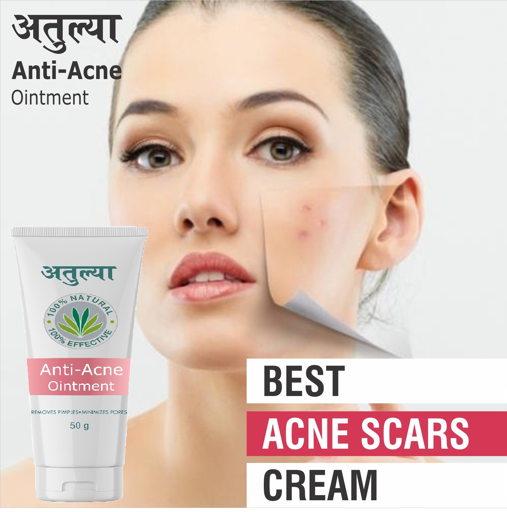 50gm Remove Pimple Minimizes Pores Ointment