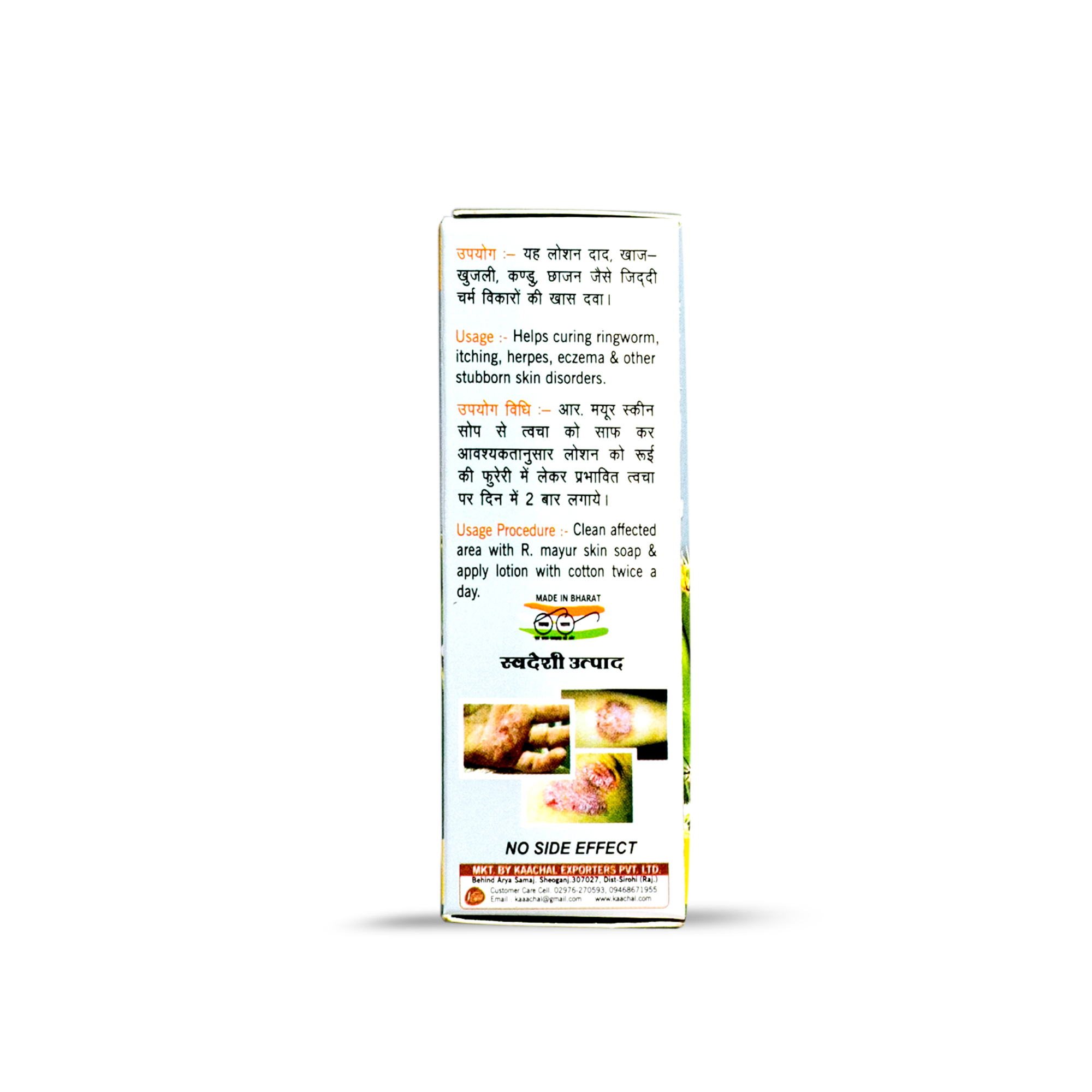 Achal Lotion - Age Group: For Adults
