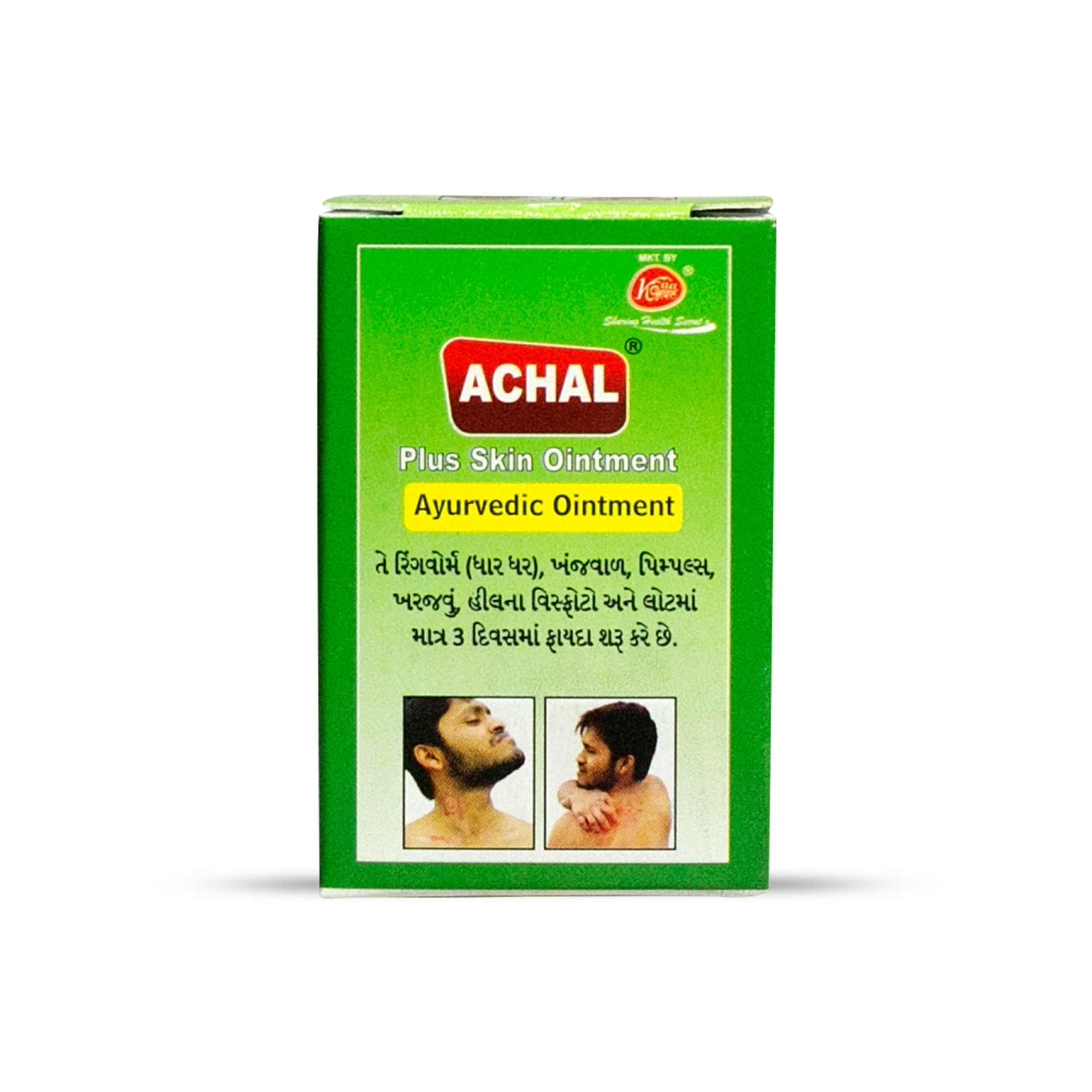 Achal Plus Skin Ointment - Age Group: Suitable For All Ages