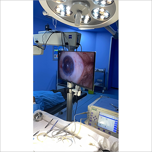 Camera Attachment For Ophthalmic Microscope - Material: Stainless Steel