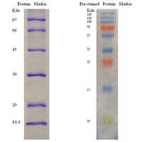 प्रोटीन मार्कर ग्रेड: प्रयोगशाला