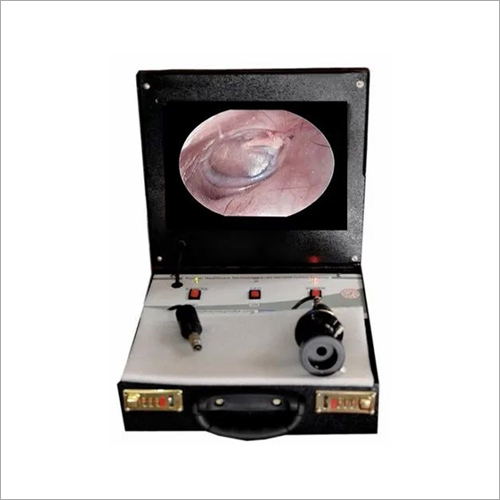 प्लास्टिक पोर्टेबल मोबाइल एंडोस्कोपी
