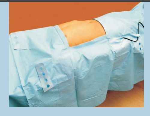 No Laparoscopy Drape - E 114