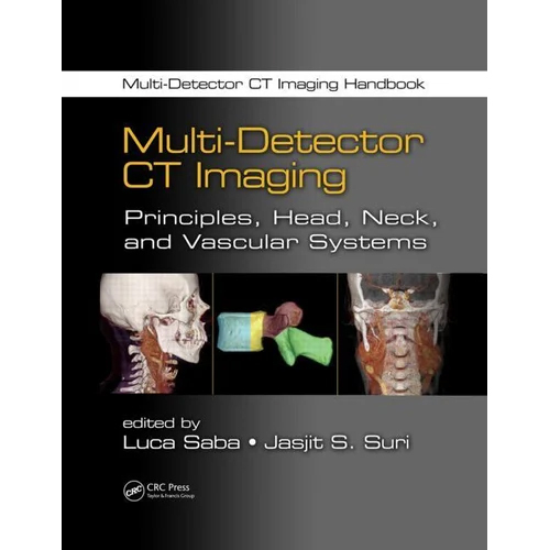 Multi-Detector Ct Imaging Book Audience: Adult