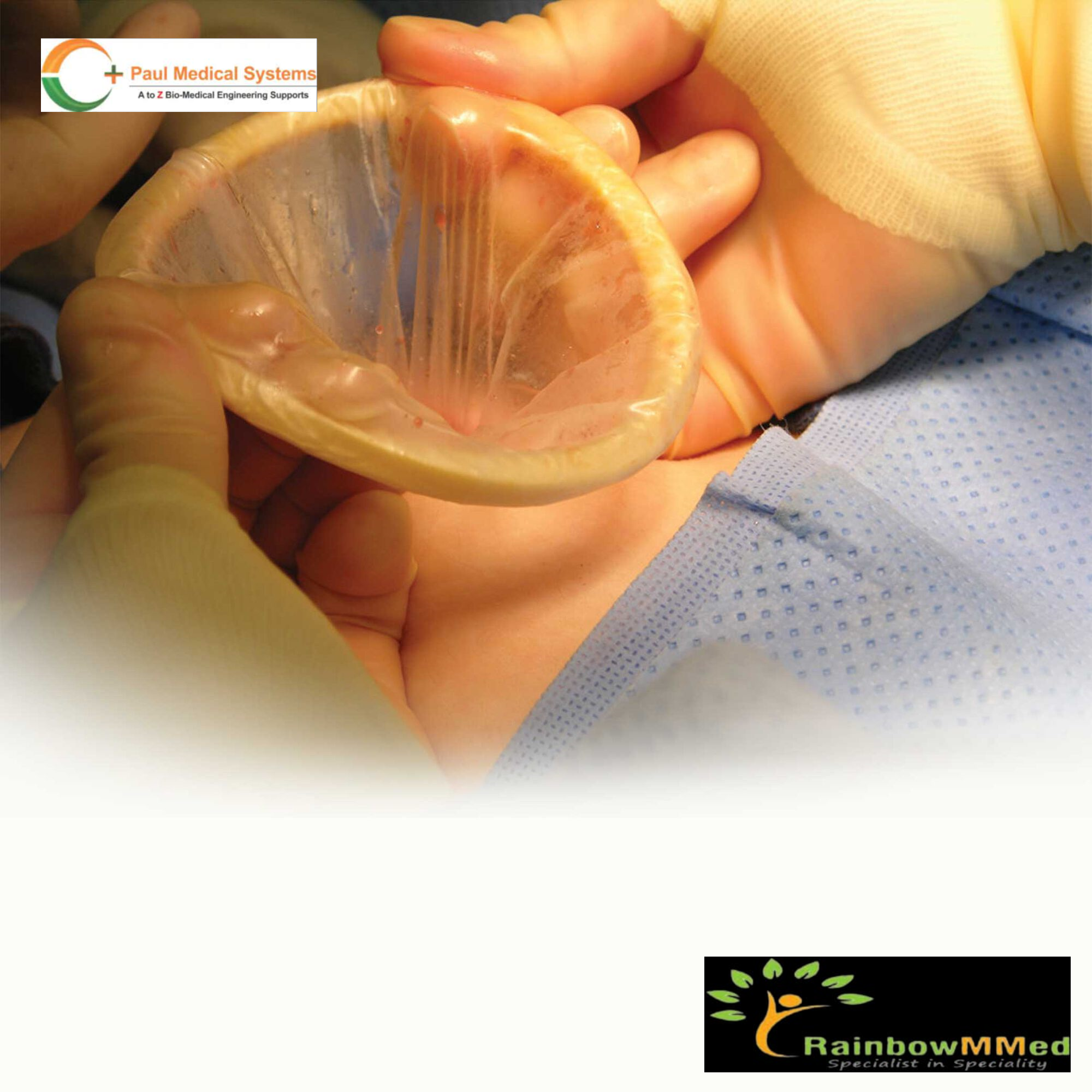 Mobius Elastic Abdominal Retractor - Flexible Plastic Design, 360-degree Gentle Retraction For Minimally Invasive Surgery, Quick Setup And Easy Removal