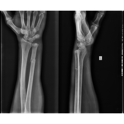 Blue X Ray Film - Application: Printing