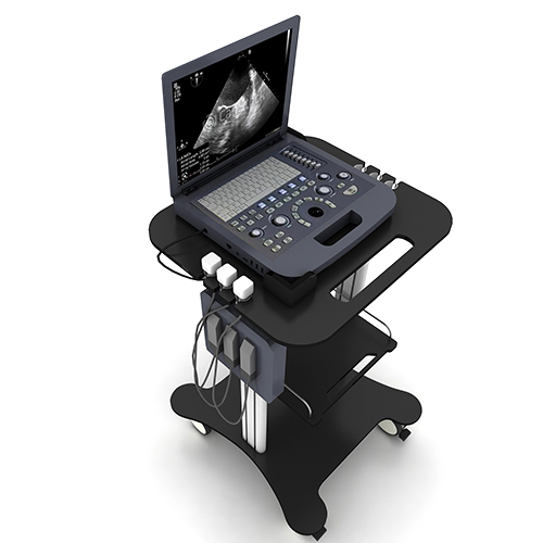 स्टेनलेस स्टील पोर्टेबल अल्ट्रासाउंड ट्रॉली