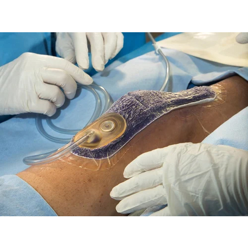 Npwt Vac Drape - Polyurethane Film, 20x30 Cm Dimensions, Transparent Color | 2 Layers, Mvtr Value 1000g/sqm-day, Medical Grade