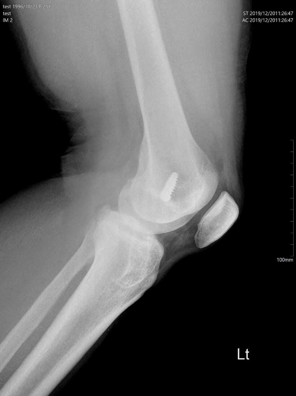 Computed Radiography Color Code: Whire